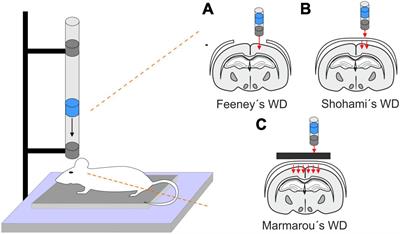 Reactive gliosis in traumatic brain injury: a comprehensive review